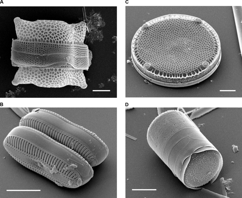 800px-Diatoms